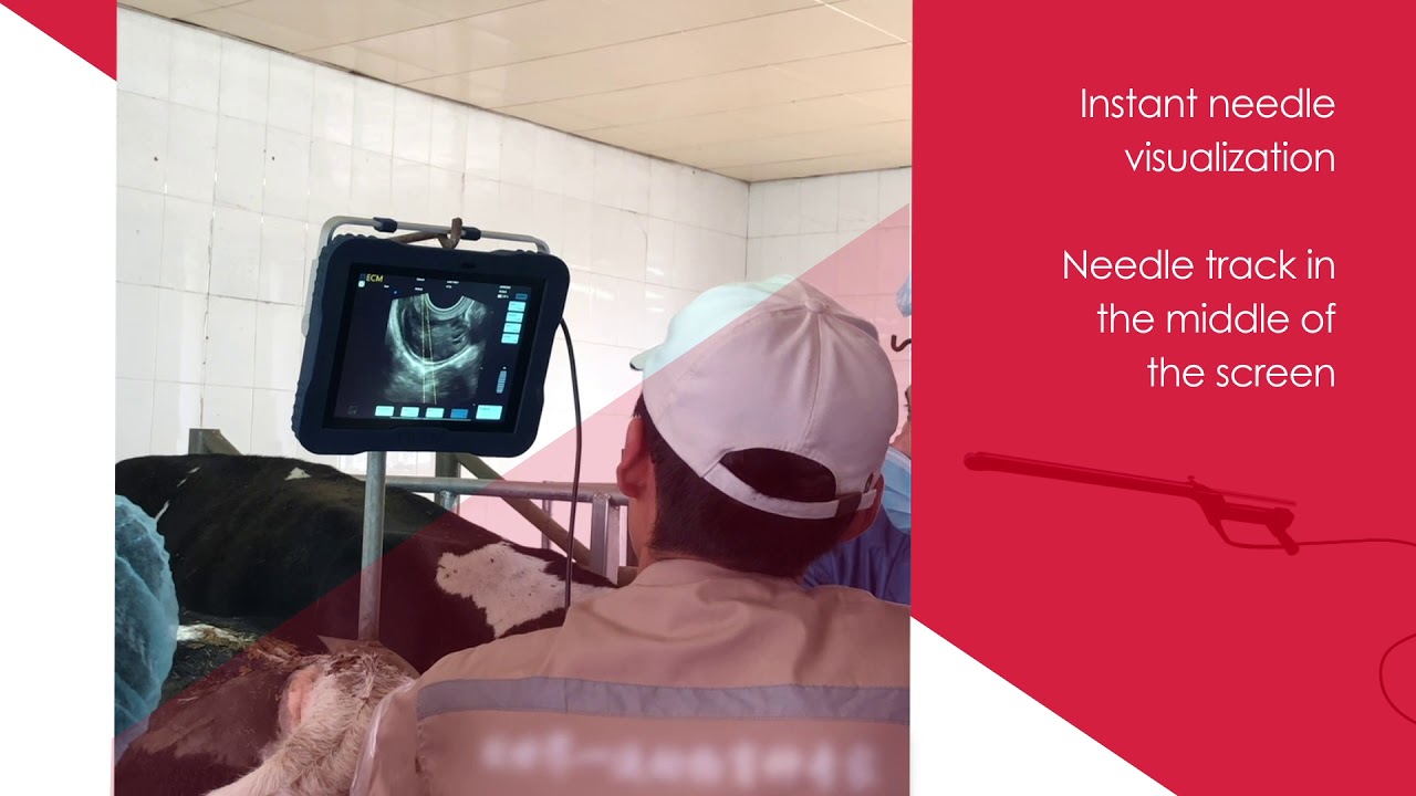 ExaPad and OPU probe