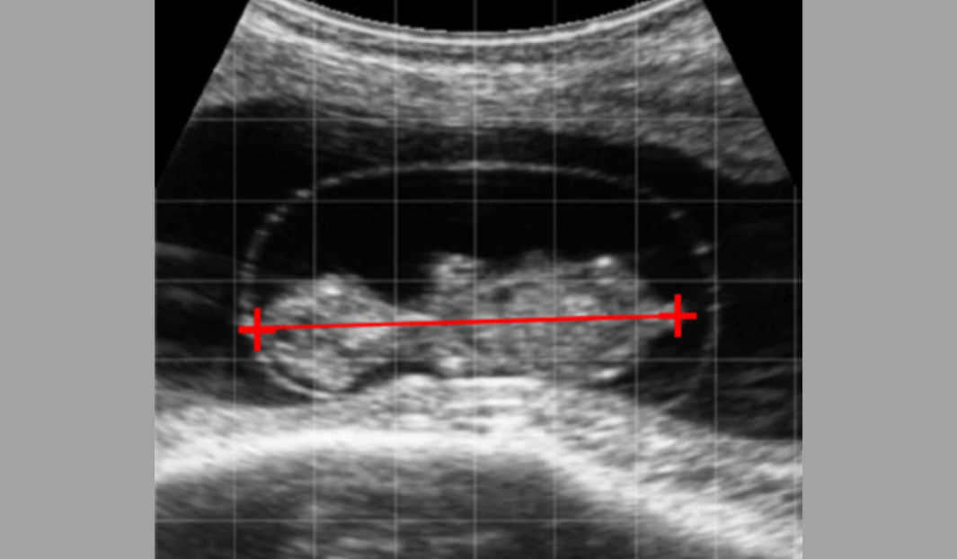 Calculation of Bovine Gestational Age: Fetal Ultrasound Measures Clarified