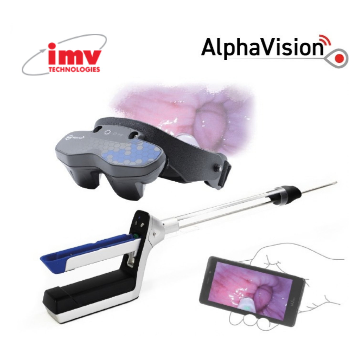 AlphaVision